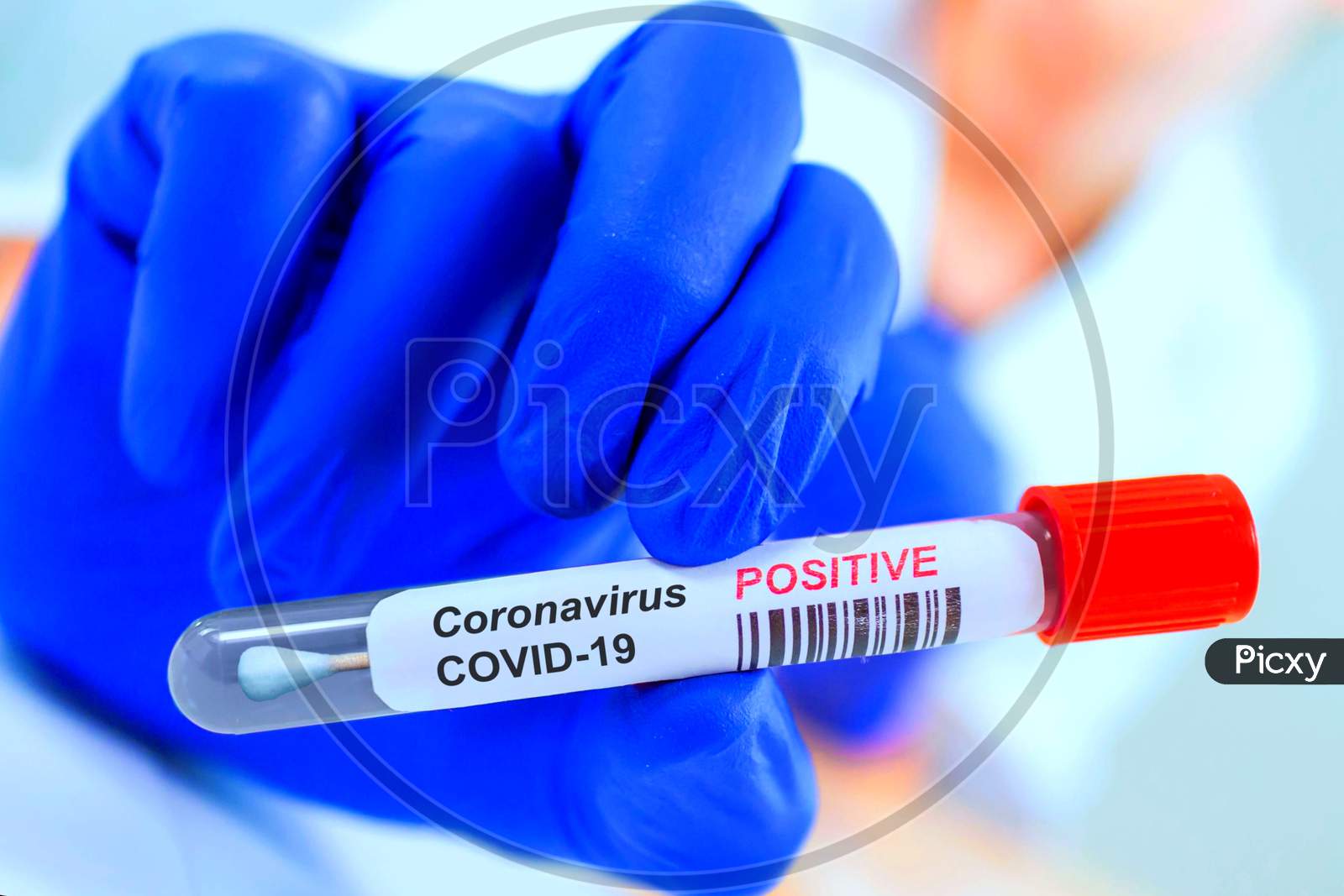 Corona Virus Infected Swab Test Sample In Doctor Hands. Covid-19 Epidemic And Virus Outbreak.