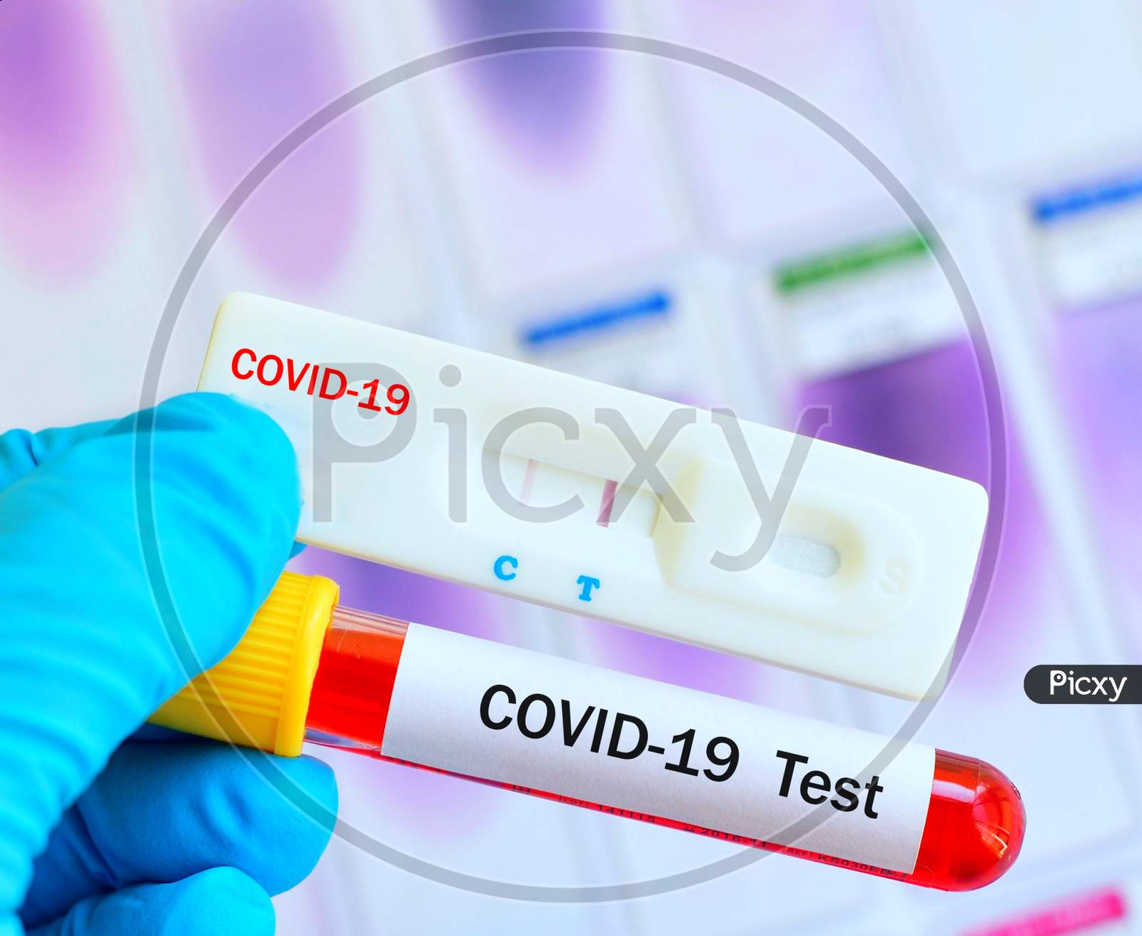 Cassette Rapid Test For Covid-19 Or Novel Corona Virus 2019 Found In Wuhan, China