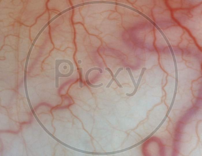 For Medical Knowledge Human Eyes Close Up Image With Veins.