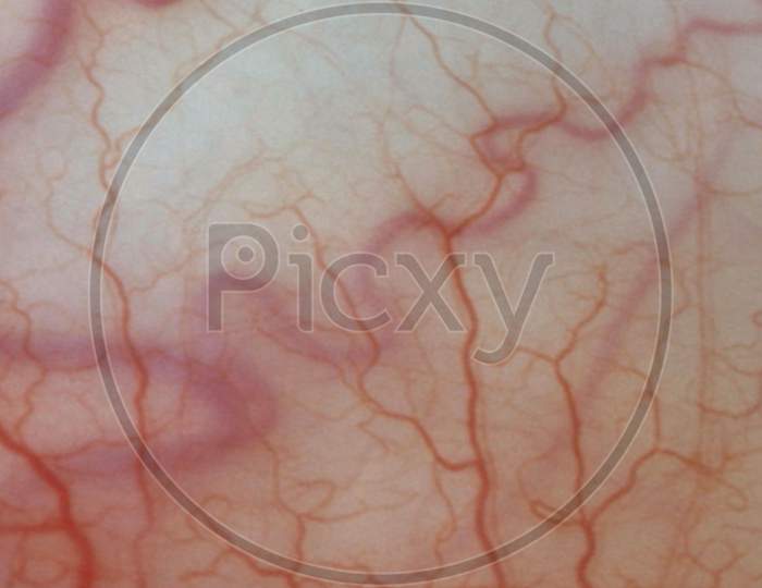For Medical Knowledge Human Eyes Close Up Image With Veins.