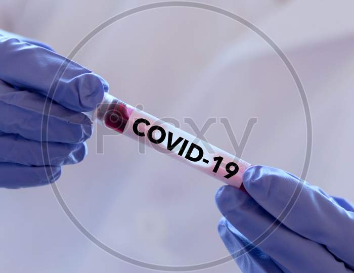 Covid-19 Named By Who For Novel Corona Virus. Lab Technician Holding Blood Sample