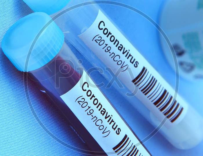 Tested Positive For Corona Virus