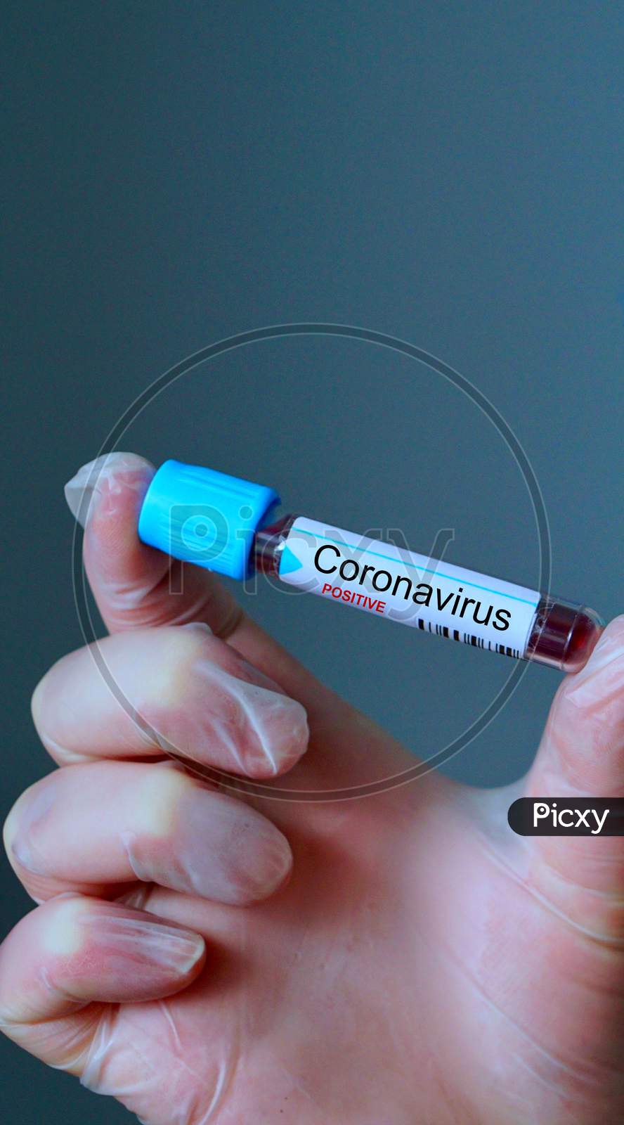Hands With Protective Glove, Examining A Novel Corona Virus Test Tube The Result Is Positive.