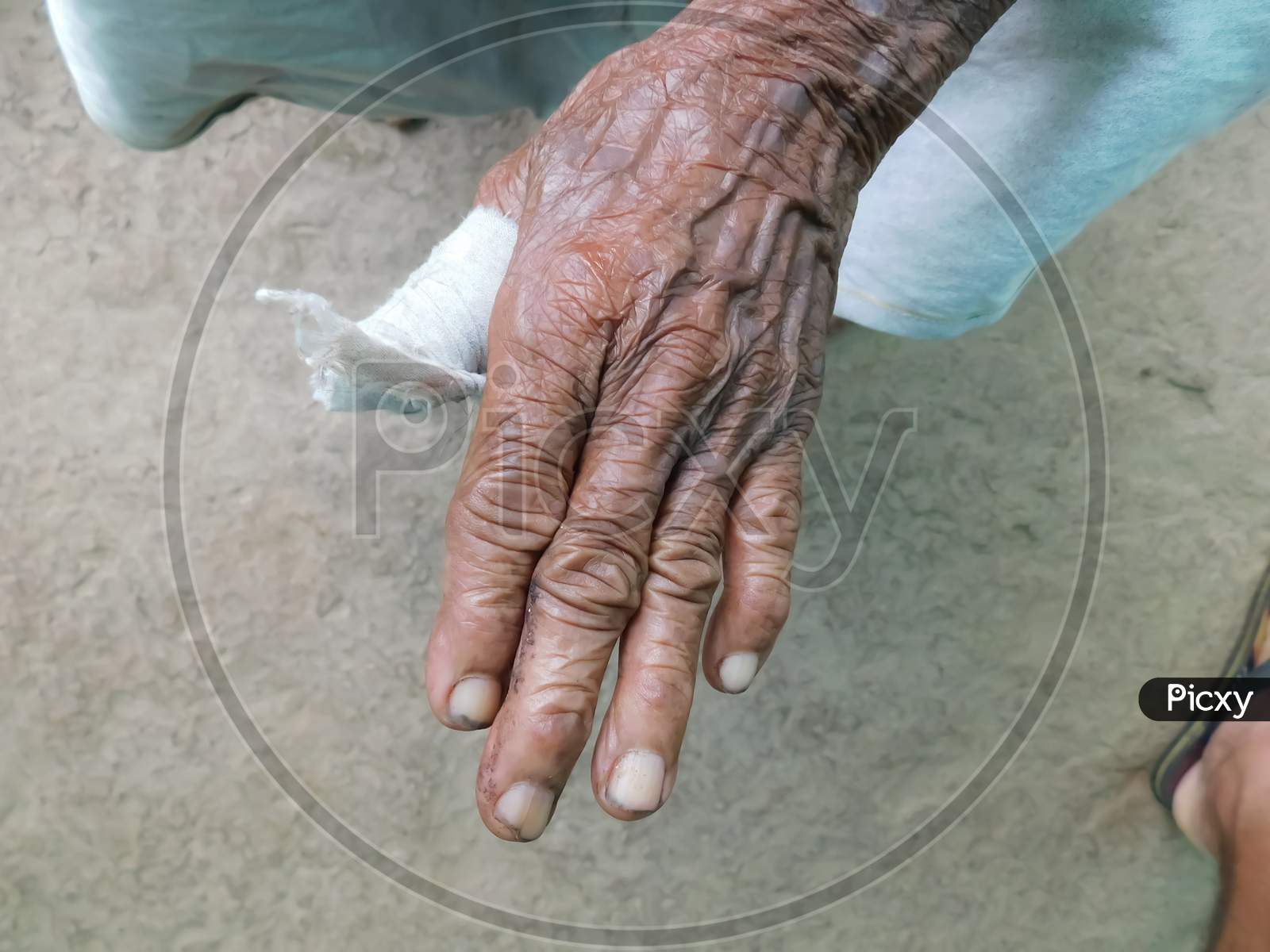 Closeup Of An Old Women Hand With Injured Finger