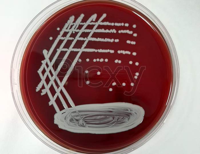 Staphylococcus epidermidis on blood agar