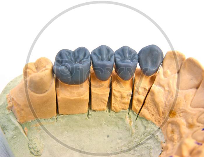 Wax Teeth Model, Close Image