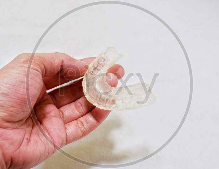 Close Up Of Ral Splint For Tmd Or Tmj Disorders