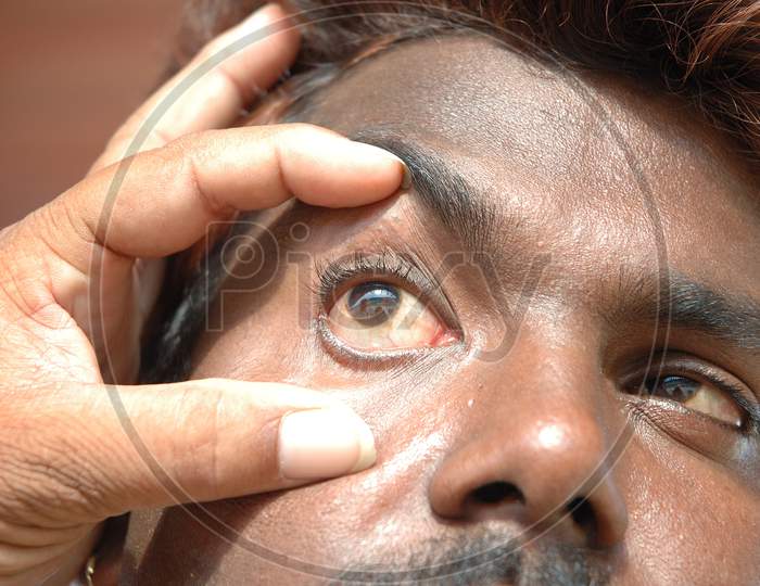 A Doctor Checking A Patient Eye At a Hospital