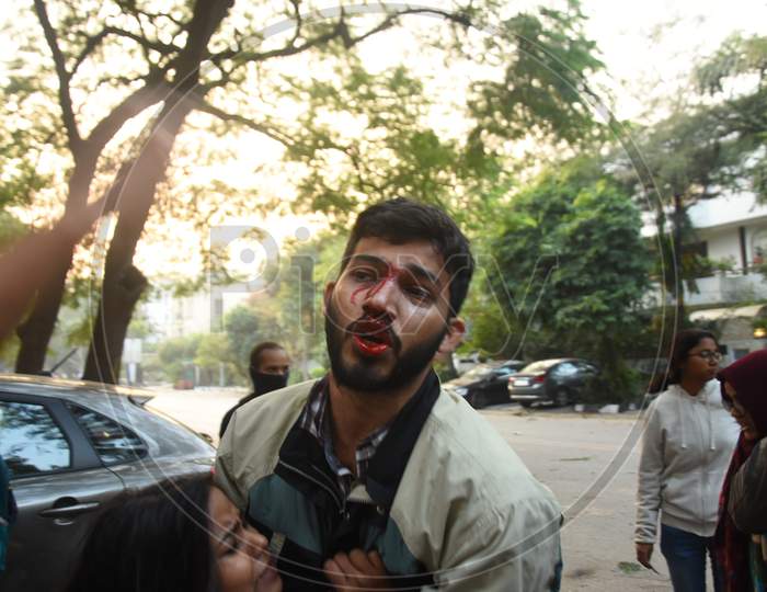 Indian Students Beaten to Blood While Participating in an Protest Against CAA, CAB and NRC Amendment Bill In Parliament