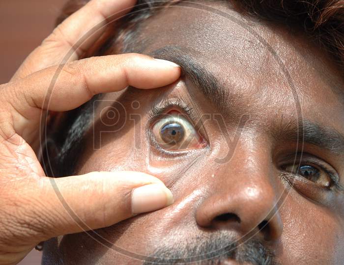 A Doctor Checking A Patient Eye At a Hospital