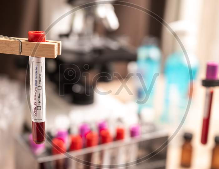 Blood Sample Test Tube For Covid-19 In Laboratory