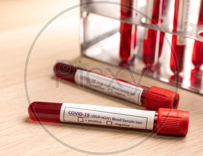 Covid-19 Blood Sample Test, 2019-Ncov Coronavirus Check-Up In Laboratory