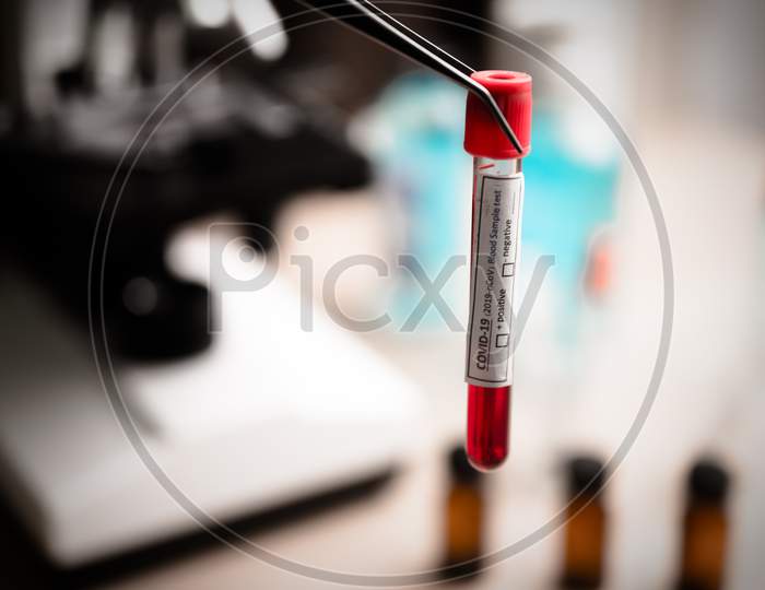 Covid-19 Blood Sample Test, 2019-Ncov Coronavirus Check-Up In Laboratory