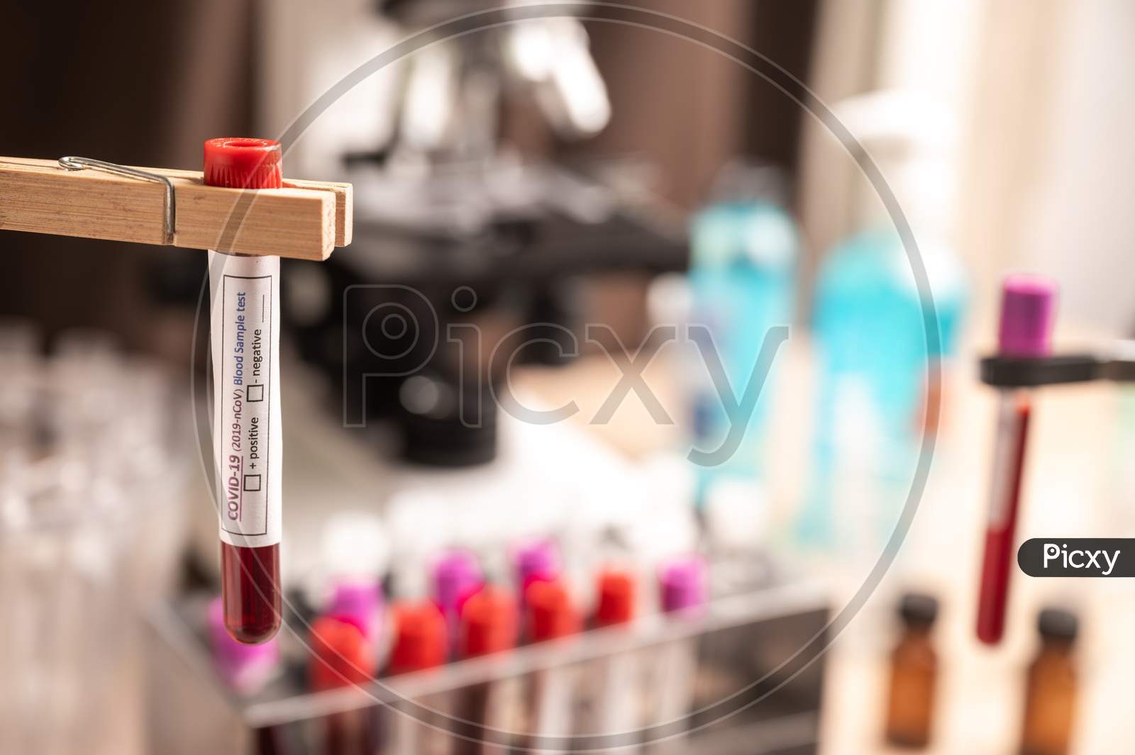 Blood Sample Test Tube For Covid-19 In Laboratory