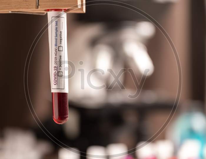 Covid-19 Test And Laboratory Sample Of Blood Testing For Diagnosis New Corona Virus Infection(Novel Corona Virus Disease 2019) From Wuhan, China. Pandemic Infectious Concept