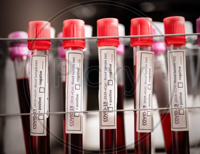 Blood Sample Test Tube For Covid-19 Test, Novel Coronavirus 2019 Found In Wuhan, China