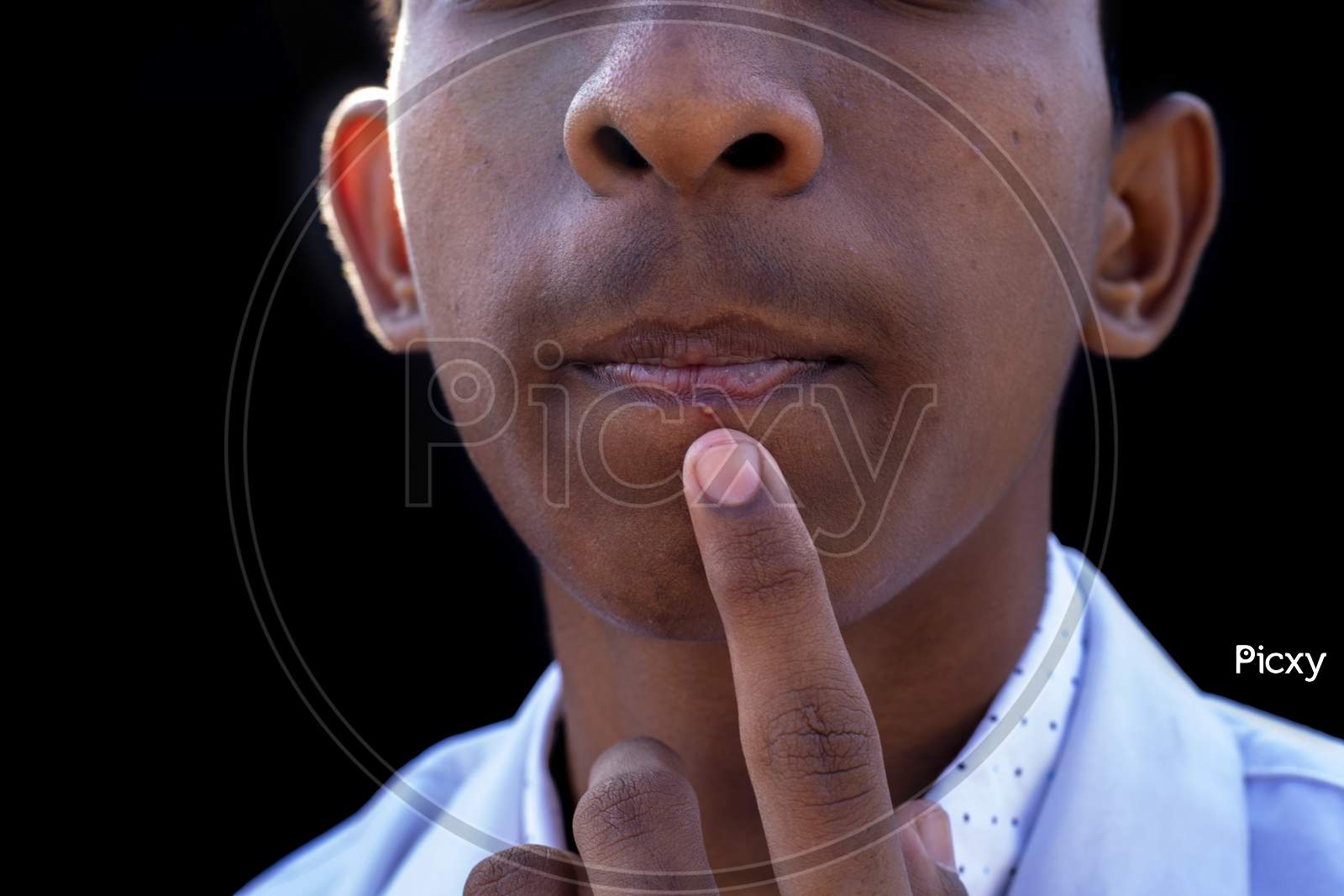 Young Man Shows Fingers On Acne On Her Face.