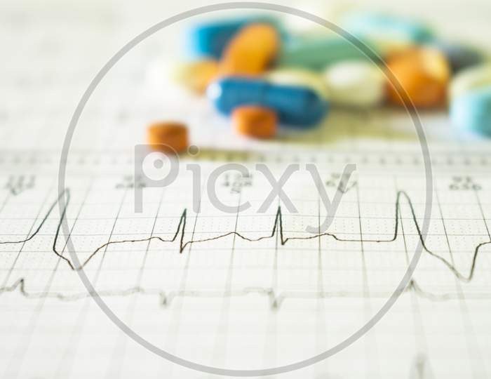 Electrocardiogram Strips With Selective Focus And Color Patterns With Selective Focus. Drugs For Legal Use.
