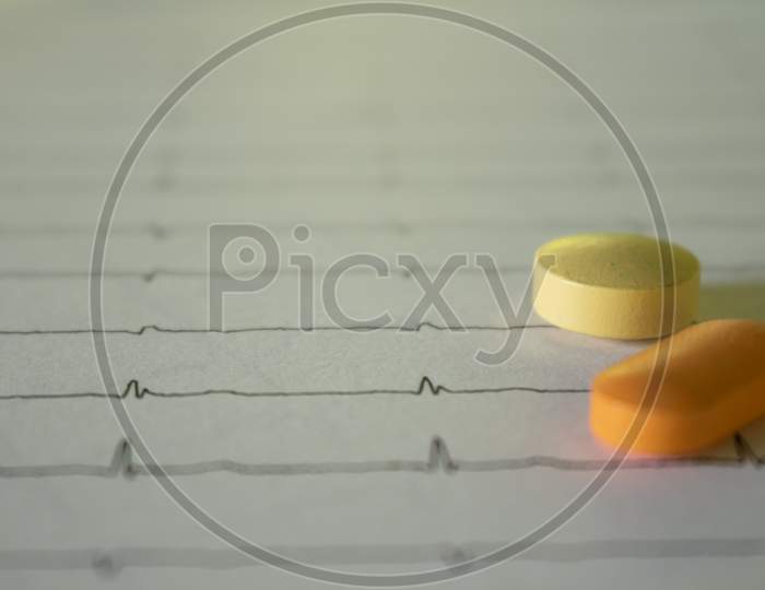 Electrocardiogram Strips With Selective Focus And Color Patterns With Selective Focus. Drugs For Legal Use.