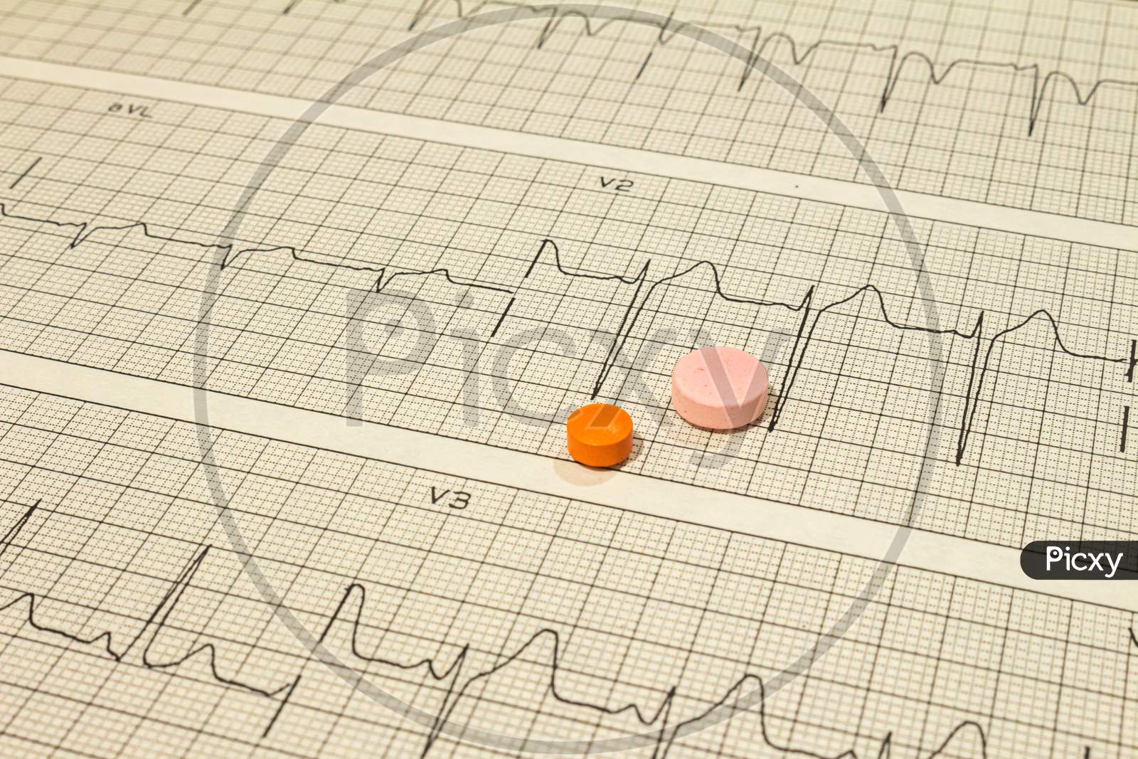 Some Pills On Electrocardiograms. Records Of Cardiac Activity. Drugs In Tablet Forms. Concept Of Cardiovascular Disease.