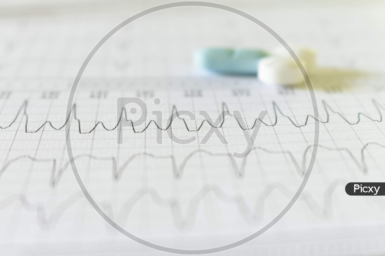 White, Blue And Light Blue Pills On An Electrocardiogram Paper. Medications For Cardiac Patients. Heartbeats Recorded On Paper.