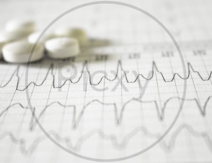 Heartbeat Represented On Paper. Electrocardiogram With Selective Focus. Pills Without Focus On Paper.