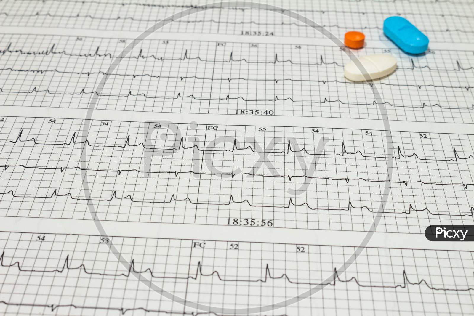 image-of-some-pills-on-electrocardiograms-records-of-cardiac-activity