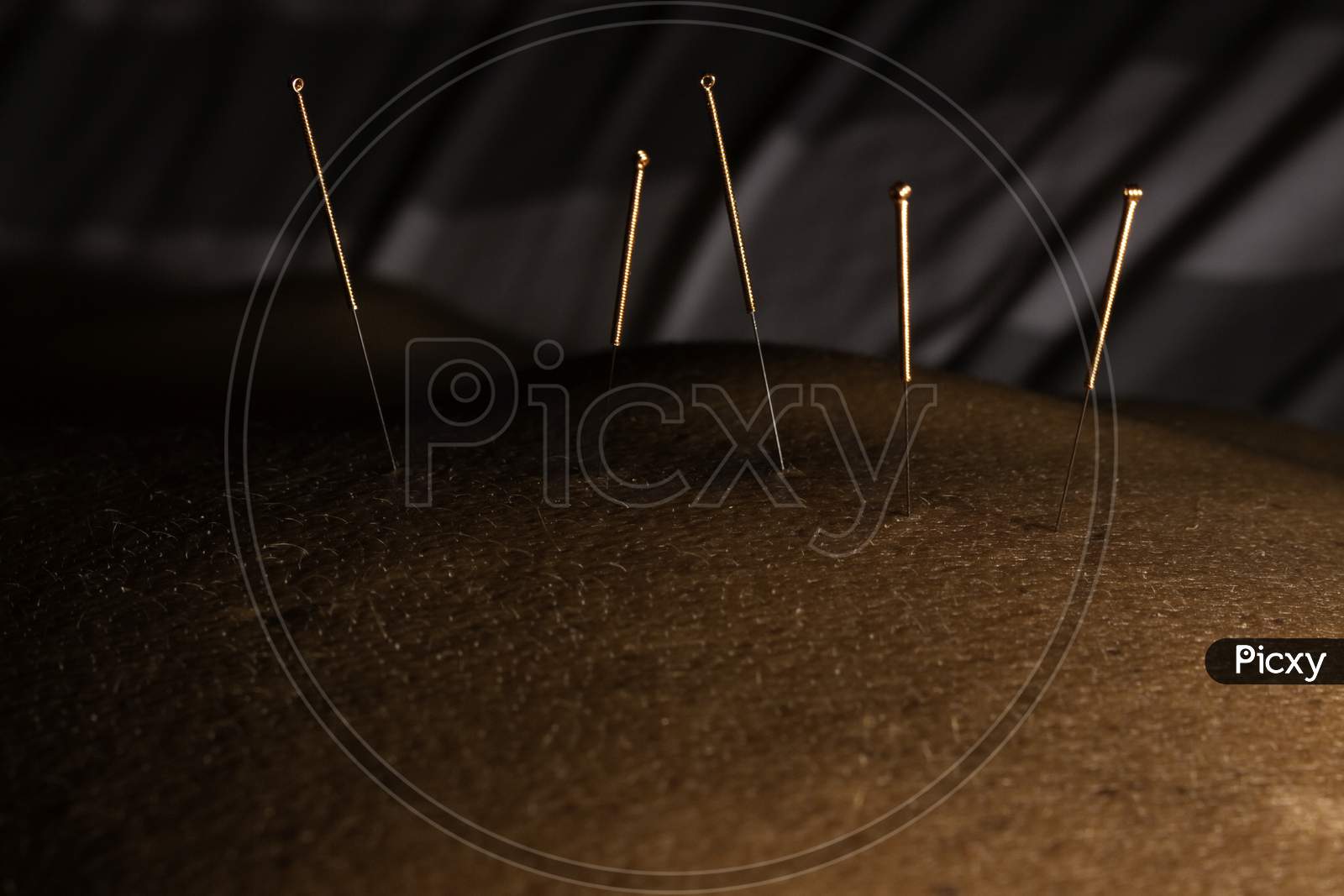 Acupuncture Needles For Treatment Using Chinese Medicine. Acupuncture On The Back For Pain In The Lumbar Region.
