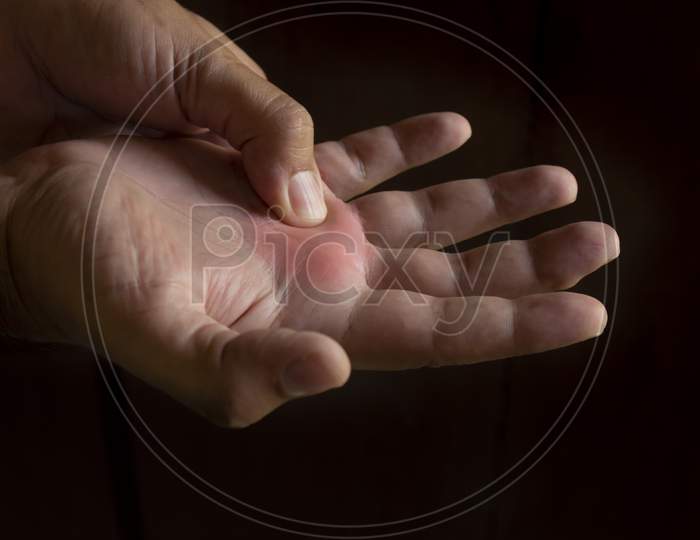 A Man'S Hand Squeezing The Joint Of The Fourth Finger Of The Right Hand. Joint Pain In The Right Hand. Black Background. Free Space To Write.
