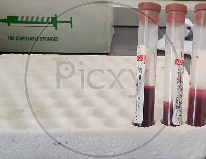 Medical testing blood sample