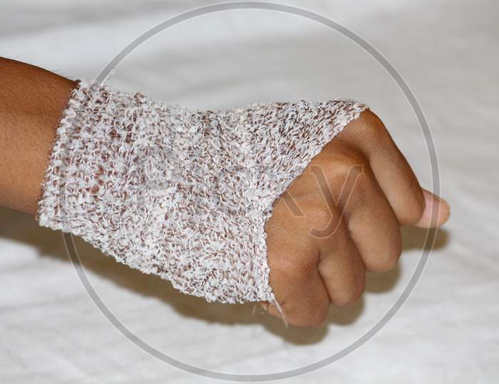 Dressing Bandaged Hand