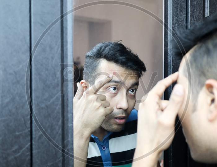 A Man Checking His Pimple In His Forehead In Front Of A Mirror. Acne Treatment Concept Image
