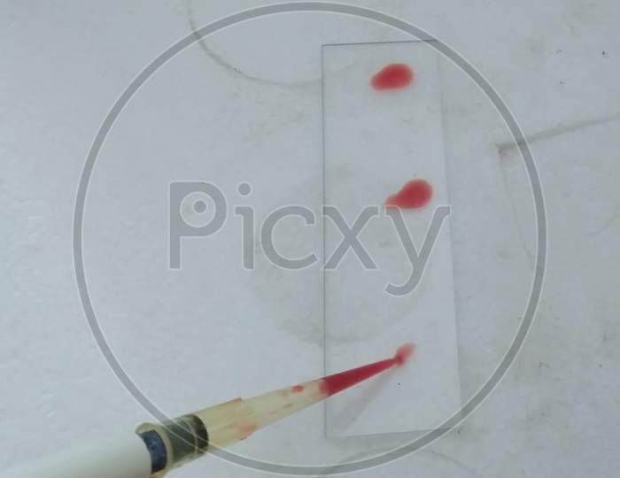 Blood test for medical lab