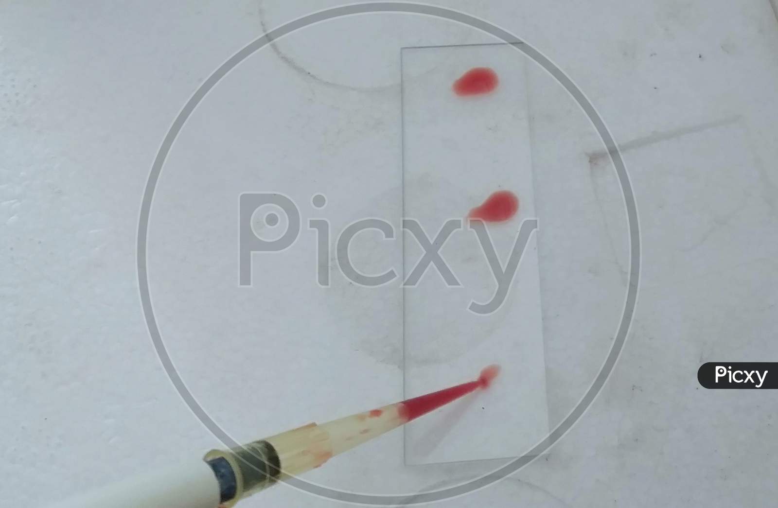 Blood test for medical lab