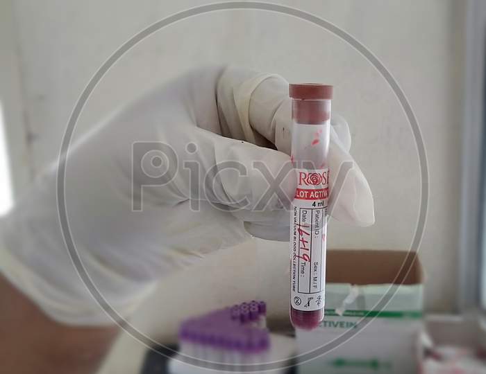 Blood sample test tub for medical