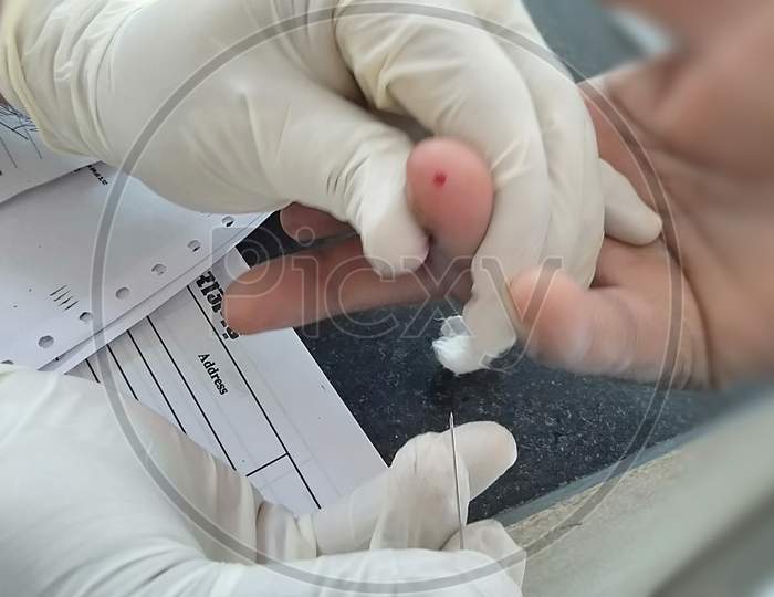 Taking blood sample by medical personnel