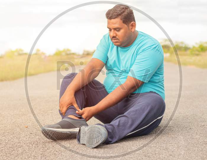Concept Of Leg Tendon Injury Of Fat Man - Obese Person Holding Leg Suffering Muscle Pain - Overweight Man Fitness Concept At Outdoor Park.