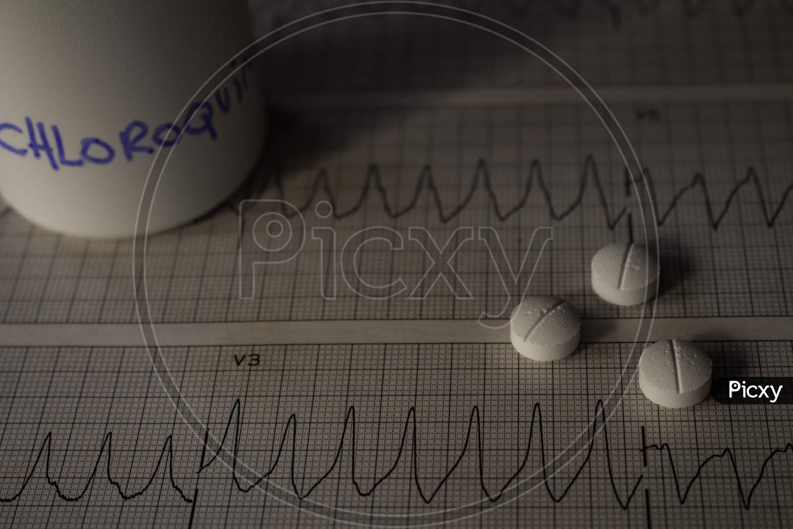 Adverse Effects On The Heart By Hydroxychloroquine Or Chloroquine. Pills On An Electrocardiogram With Cardiac Arrhythmias. White Container With "Hydroxychloroquine" Written On The Side.