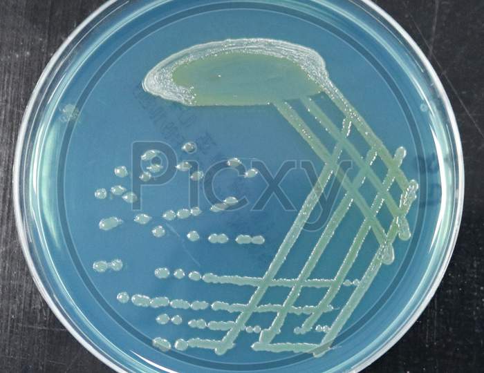 CLED agar shows non lactose fermenting colonies