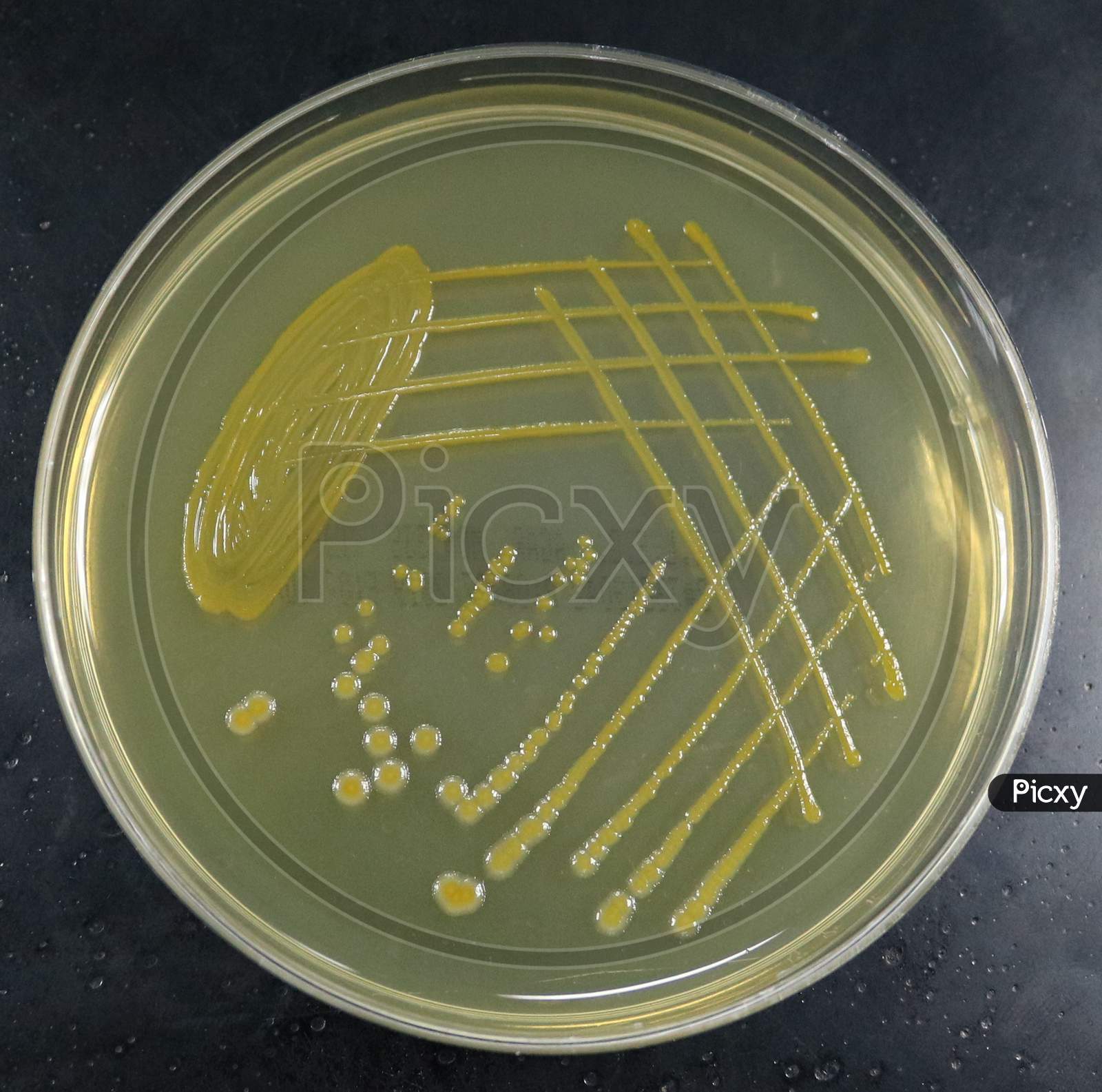 image-of-cled-agar-shows-lactose-fermentation-gm429270-picxy