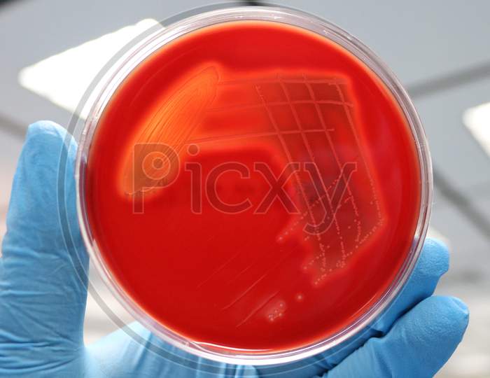 Blood agar shows beta hemolysis