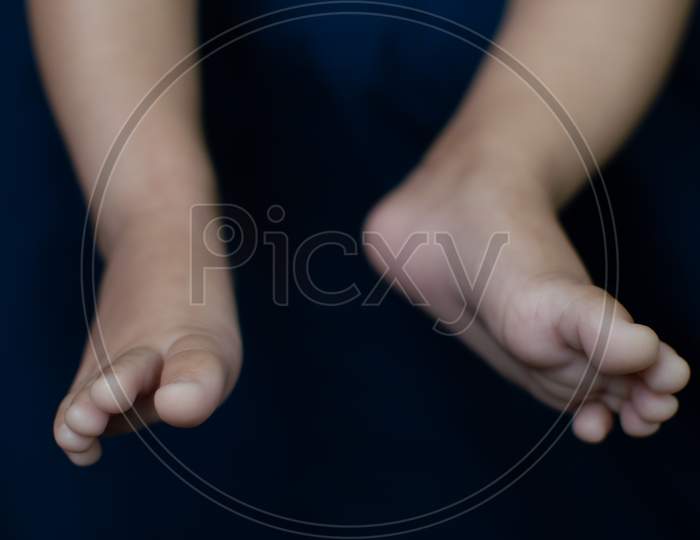 Infant Legs Close Up With Open Legs