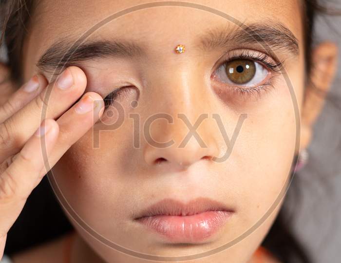 Extreme Close Up Of Child Rubbing Her Eyes - Concept Showing To Prevent And Avoid Touching Your Eyes. Protect From Covid-19 Or Coronavirus Infection Or Outbreak - Don T Touch Your Eyes.