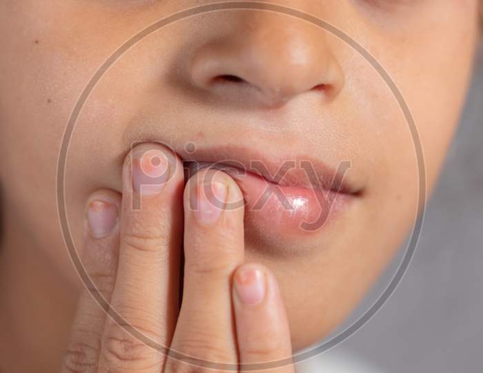 Extreme Close Up Of Child Touch'S Her Mouth - Concept Showing To Prevent And Avoid Touching Your Mouth. Protect From Covid-19 Or Coronavirus Spreading Or Outbreak - Don T Touch Your Mouth.