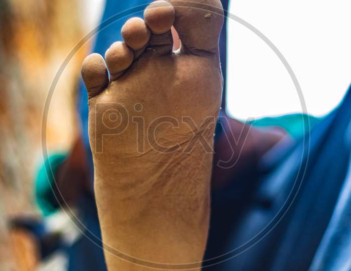 Men Feet Foot Legs On Low Angle Frame. Foot Pain. Men Sitting And Show Painful Foot. Having Painful Feet And Stretching Muscles Fatigue To Relieve Pain. Health Concepts. Human Foot With Leg Fingers.