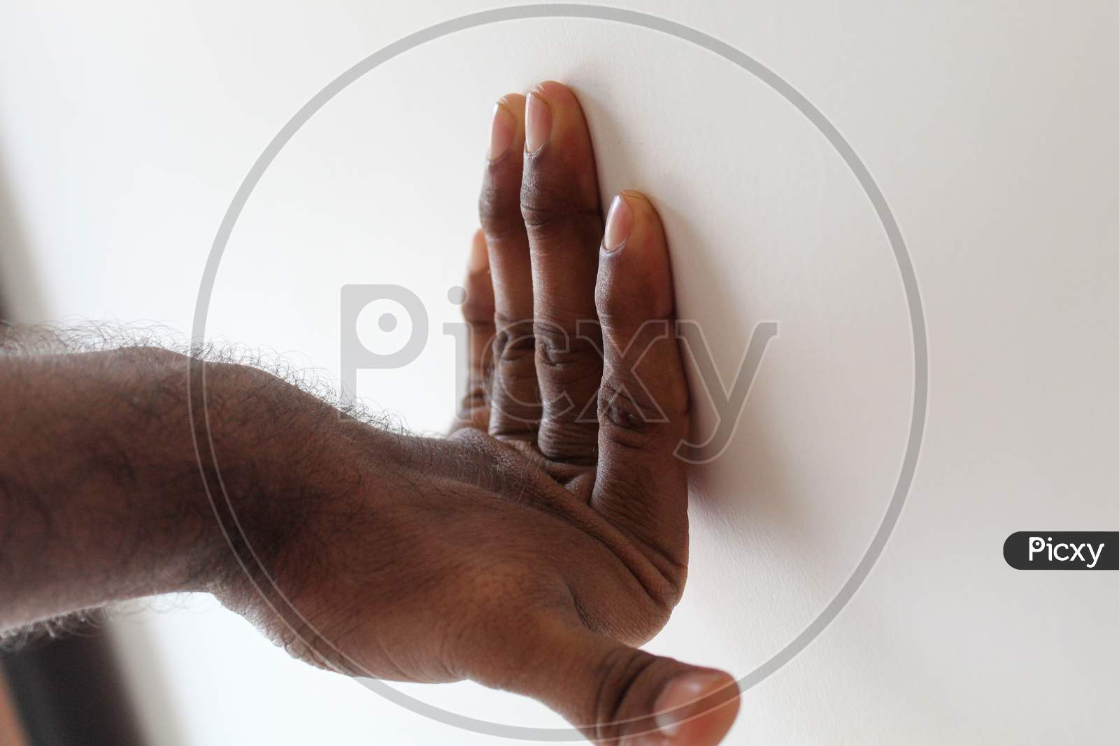 Hypermobility Syndrome Of Fingers In A Young Man.