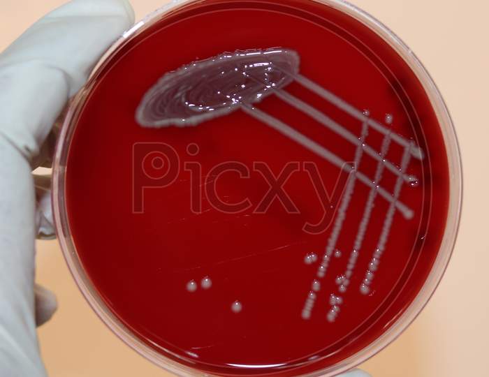Blood agar with different types of haemolysis