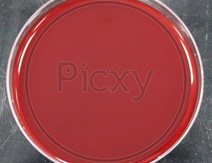 Blood agar with different types of haemolysis
