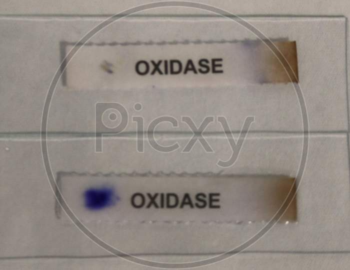 Oxidase test is a biochemical test for oxidase positive bacteria and oxidase negative bacteria