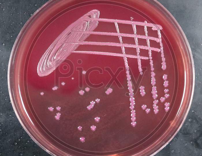 MacConkey agar with lactose fermenting and non lactose fermenting colonies